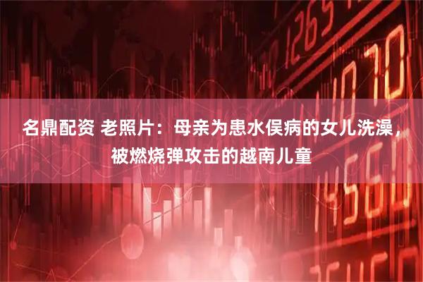 名鼎配资 老照片：母亲为患水俣病的女儿洗澡，被燃烧弹攻击的越南儿童